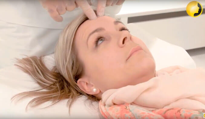 Video Thumb - Faltenbehandlung mit Botox