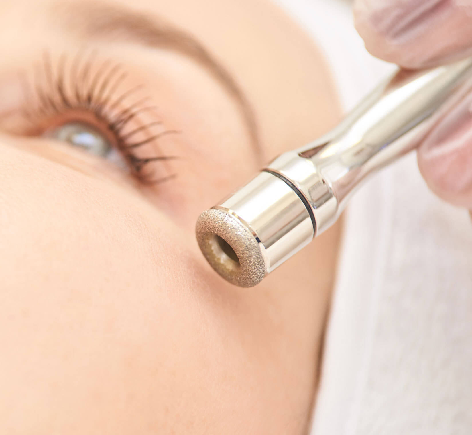 Microdermabrasion in Berlin