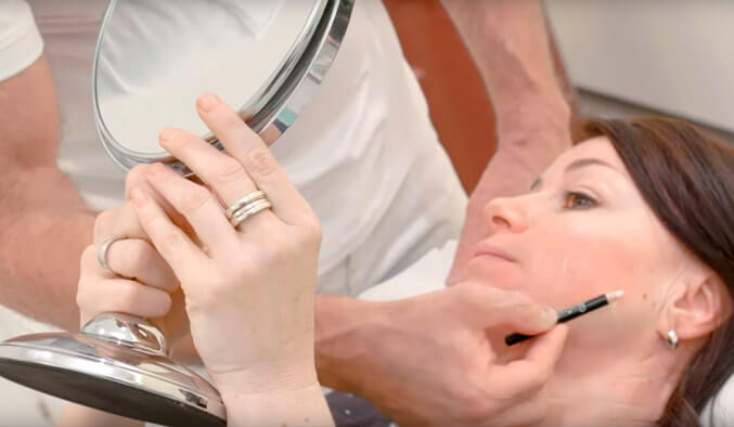 Video Thumb - Fadenlifting Gesicht und Wangen