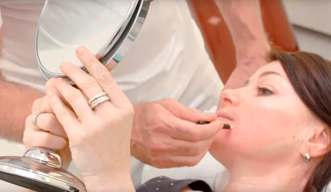 Video Thumb - Fadenlifting zur Konturstraffung