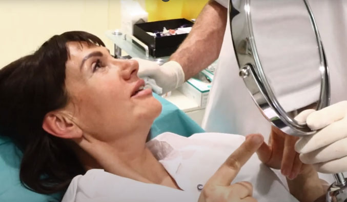 Video Thumb - Gesichtsverüngung bei Dr. Lange Ästhetikwelt Berlin