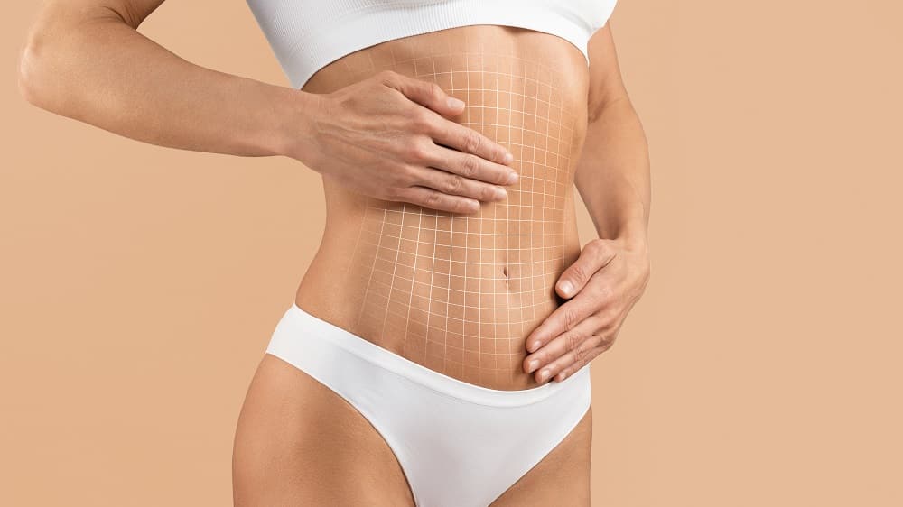 Body Contouring ohne OP