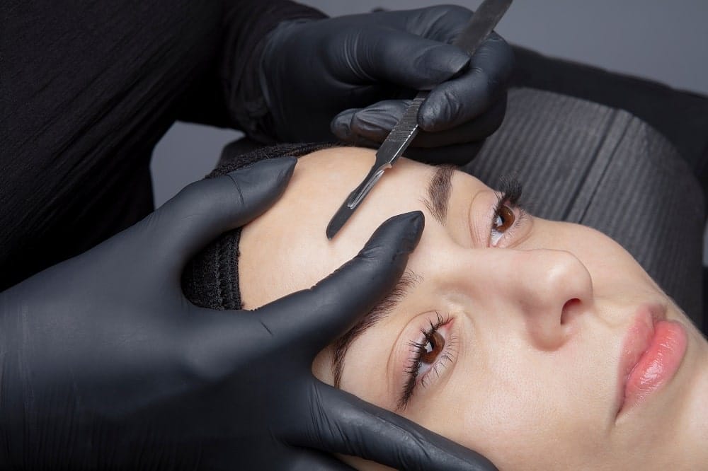 Dermaplaning